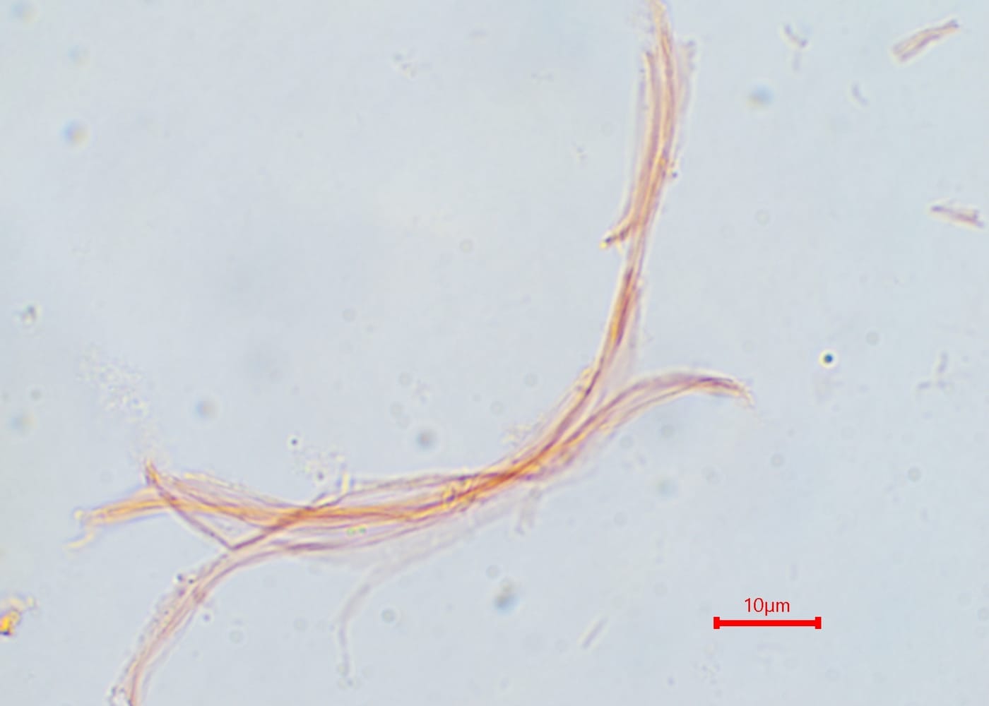Cordyceps (Cordyceps militaris)